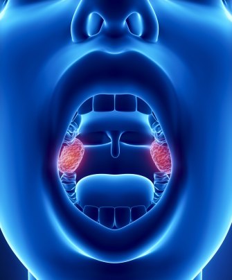 Першение в горле: чем лечить, почему появляется, способы смягчить сухость и снять симптом