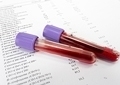 Сдать анализ крови на маркеры вирусных гепатитов thumbnail