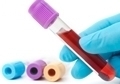 Анализ крови расшифровка понижены тромбоциты thumbnail
