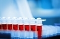 Чем отличается общий анализ крови от лейкоцитарной формулы thumbnail