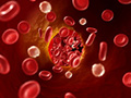 Что влияет на анализ крови на холестерин thumbnail