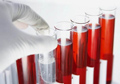 Как сдавать анализы крови на пролактин thumbnail