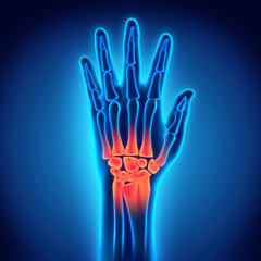 liječenje artroze 2. stupnja zgloba gležnja komplikacije nakon bolova u hladnom zglobu