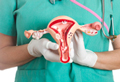 Эмболизация маточных артерий противопоказания последствия thumbnail