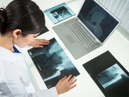 Что показывает рентген суставов