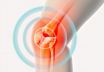 Evo kako da liječite artrozu koljena