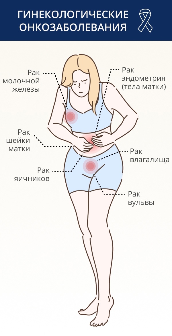 Рак вульвы — первые признаки и симптомы, лечение онкологии вульвы в Москве