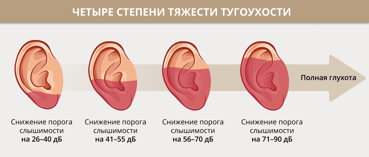 Симптомы снижения слуха у взрослых