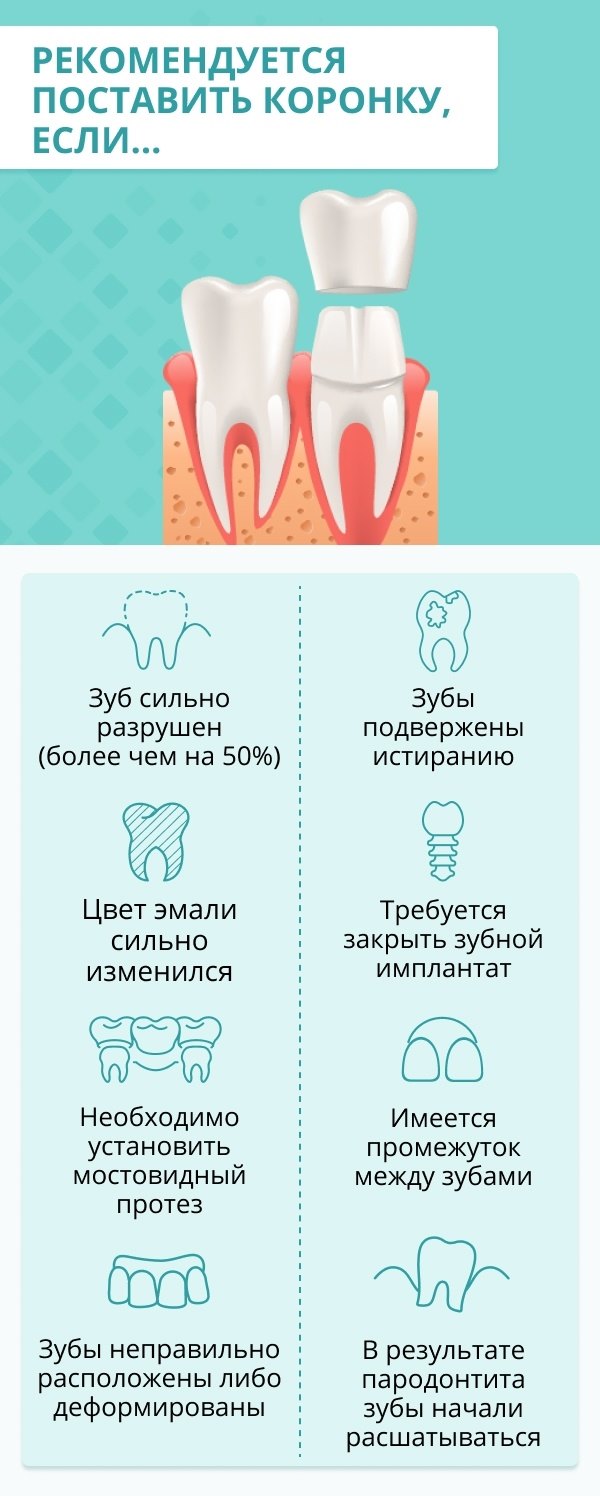 Как проводится установка коронки на зуб и сколько это стоит