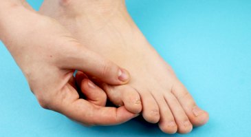 Грибок ногтей – лечение народными средствами