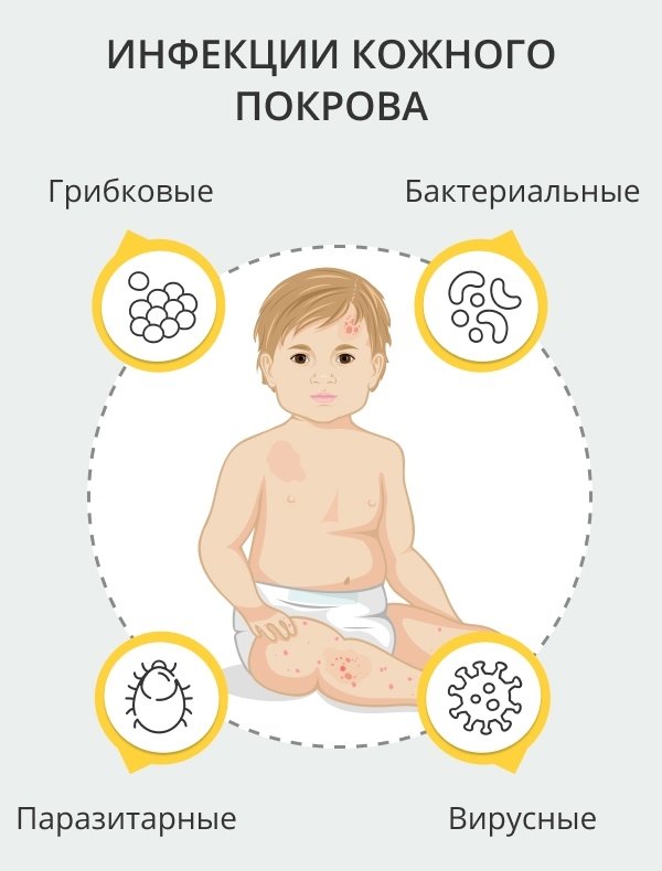 Детские болезни с сыпью таблица фото на русском
