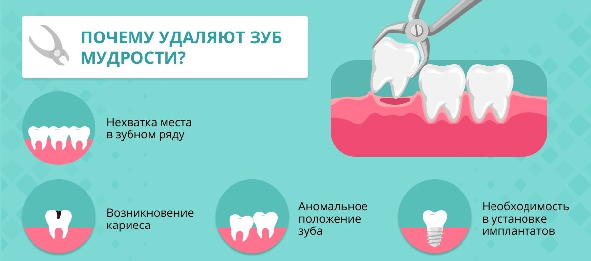 Стоматология удаление зуба мудрости москва