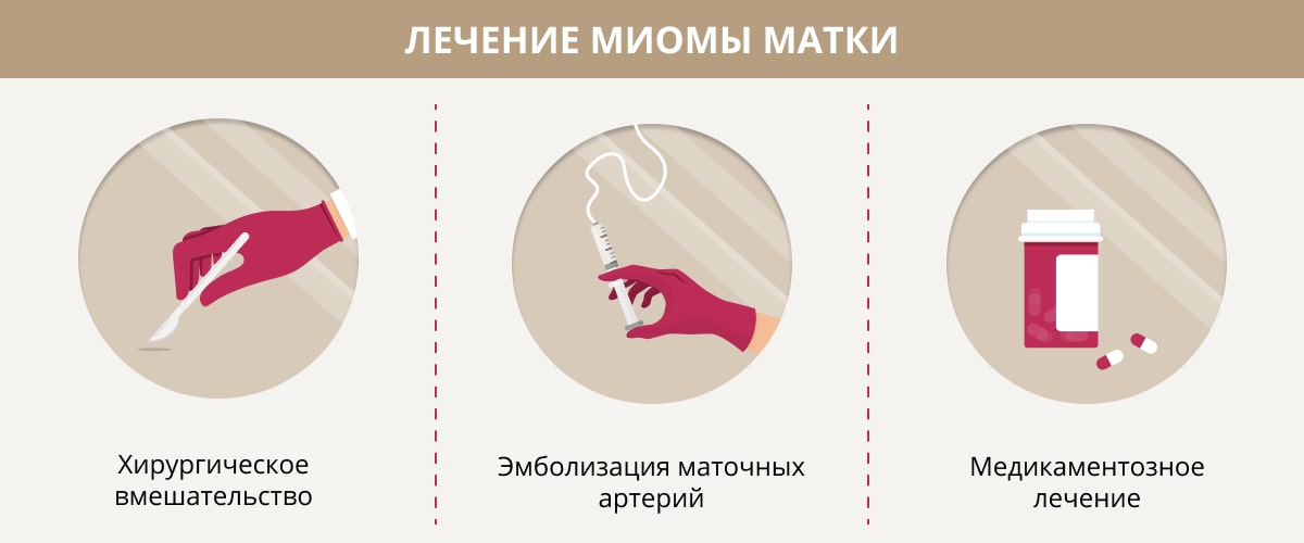 Лечение миомы матки в Краснодаре в клинике УРО-ПРО