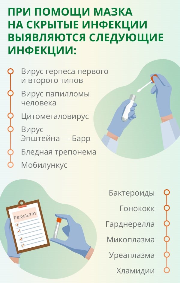 Мазок на инфекции у женщин: показания к назначению, особенности проведения  и подготовка к исследованию