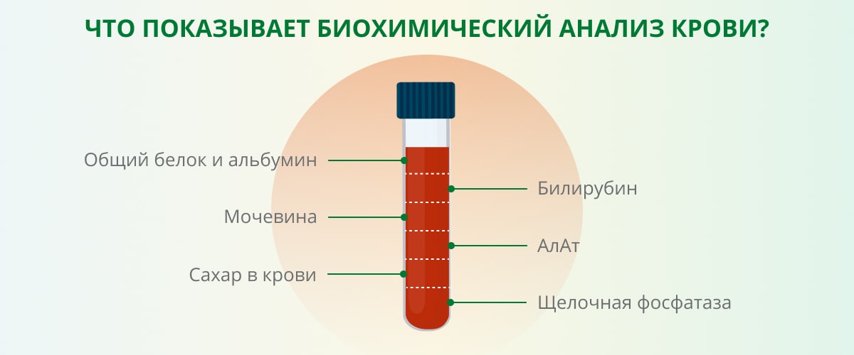 Центр лабораторных технологий АБВ - Каким будет анализ крови и мочи при ОРВИ у взрослого?