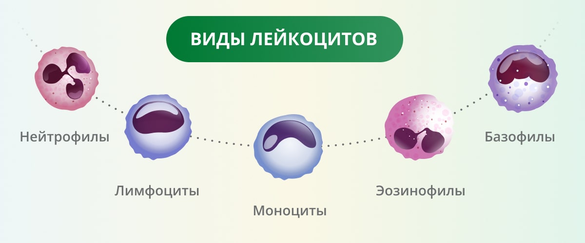 Повышены нейтрофилы моноциты и лимфоциты