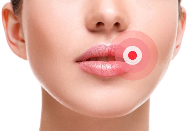 Пупырышки на губах: причины возникновения | Real Woman — самый женский сайт
