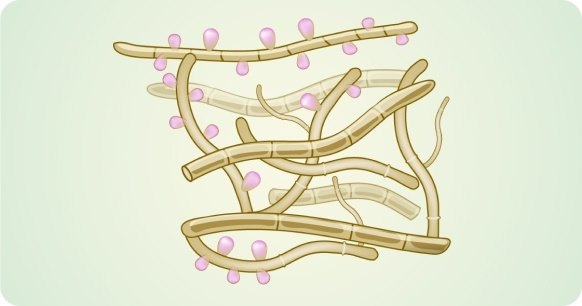 Распространенные виды стафилококков