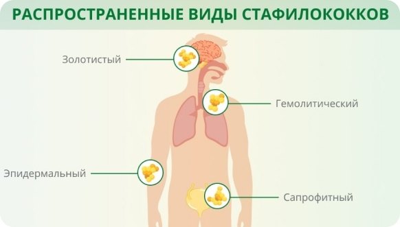 Распространенные виды стафилококков
