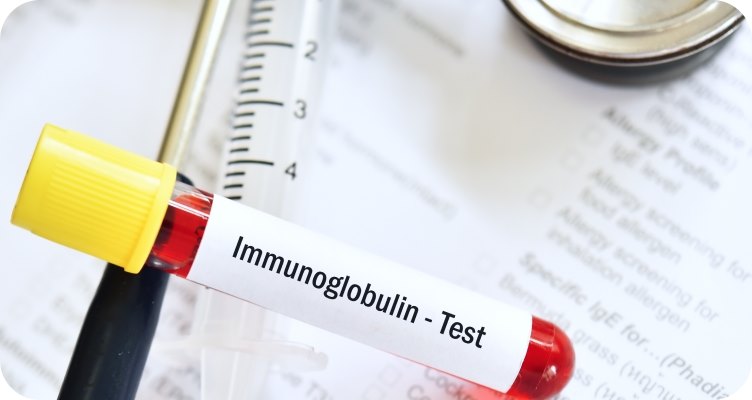 Расшифровка иммуноферментного анализа