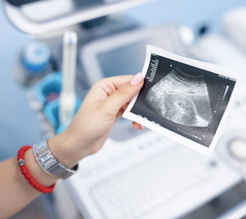 Что делать женщине после подсадки эмбрионов при ЭКО?