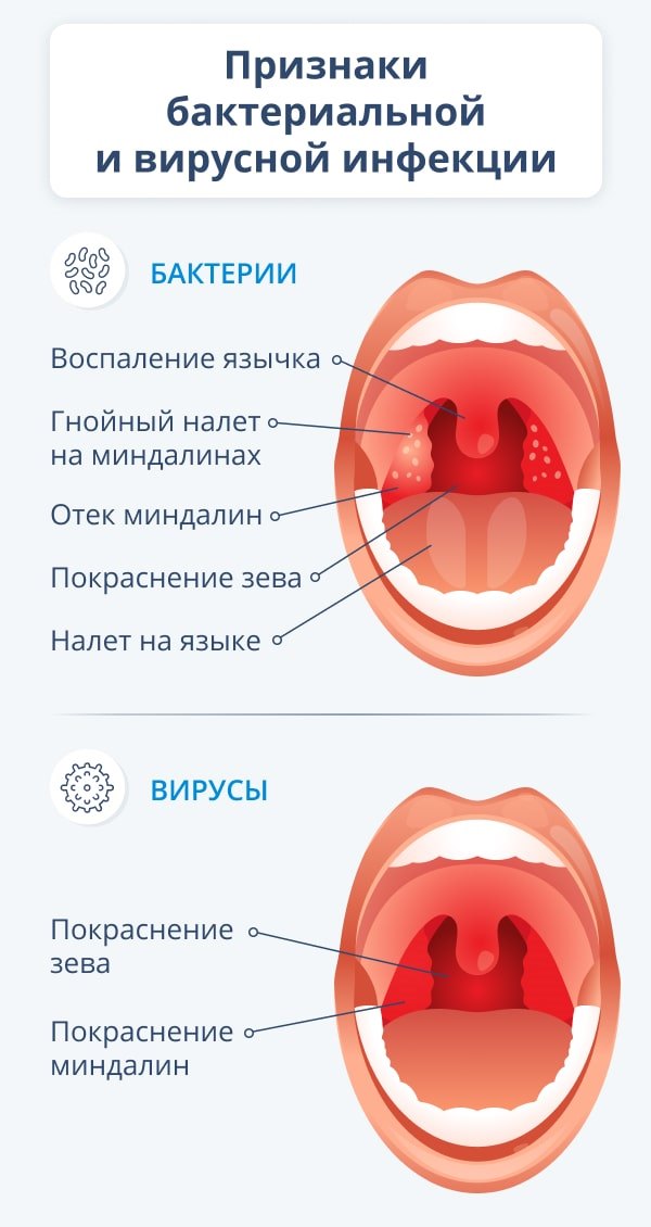 Как вызвать боль в горле и сделать его красным