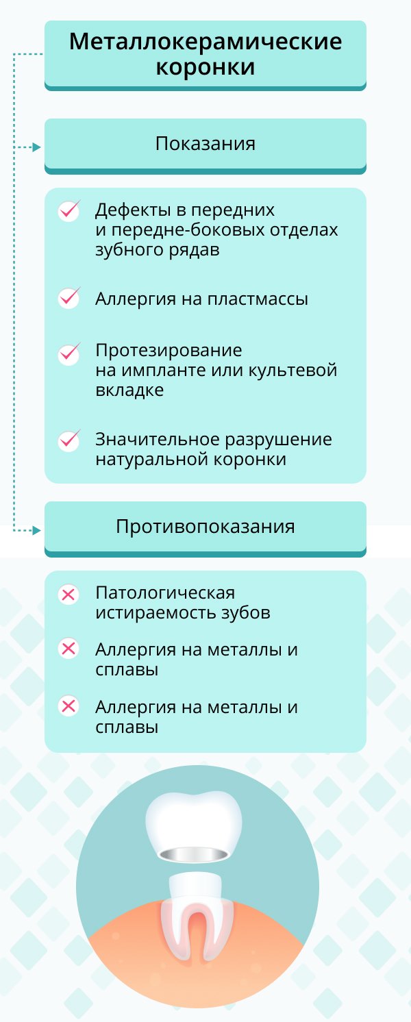 Безметалловая керамика: что это, чем отличается от металлокерамики,  технология установки керамических коронок на зубы