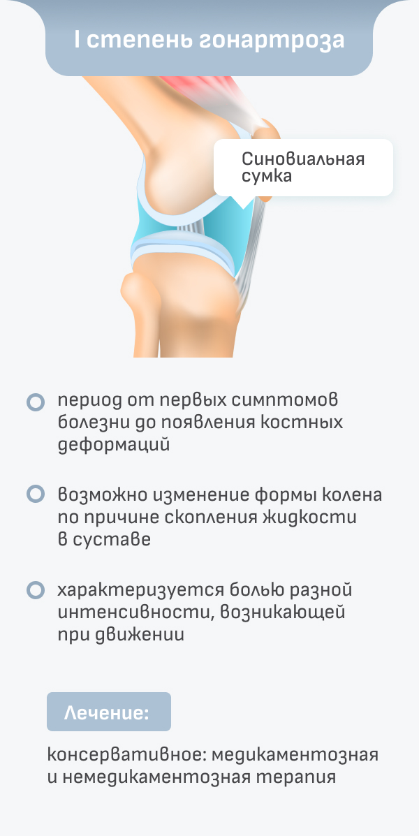 Классификация гонартроза коленного сустава. Стадии гонартроза