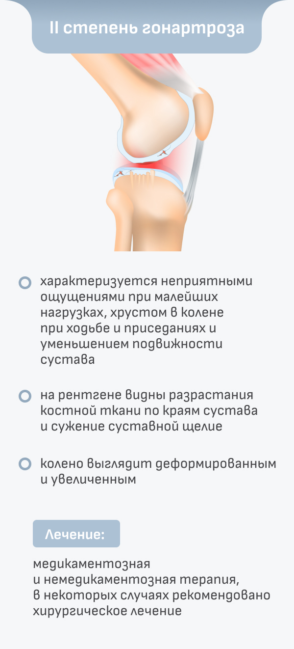 Артроз коленного сустава (гоноартроз): лечение, степени, препараты,  симптомы остеоартроза