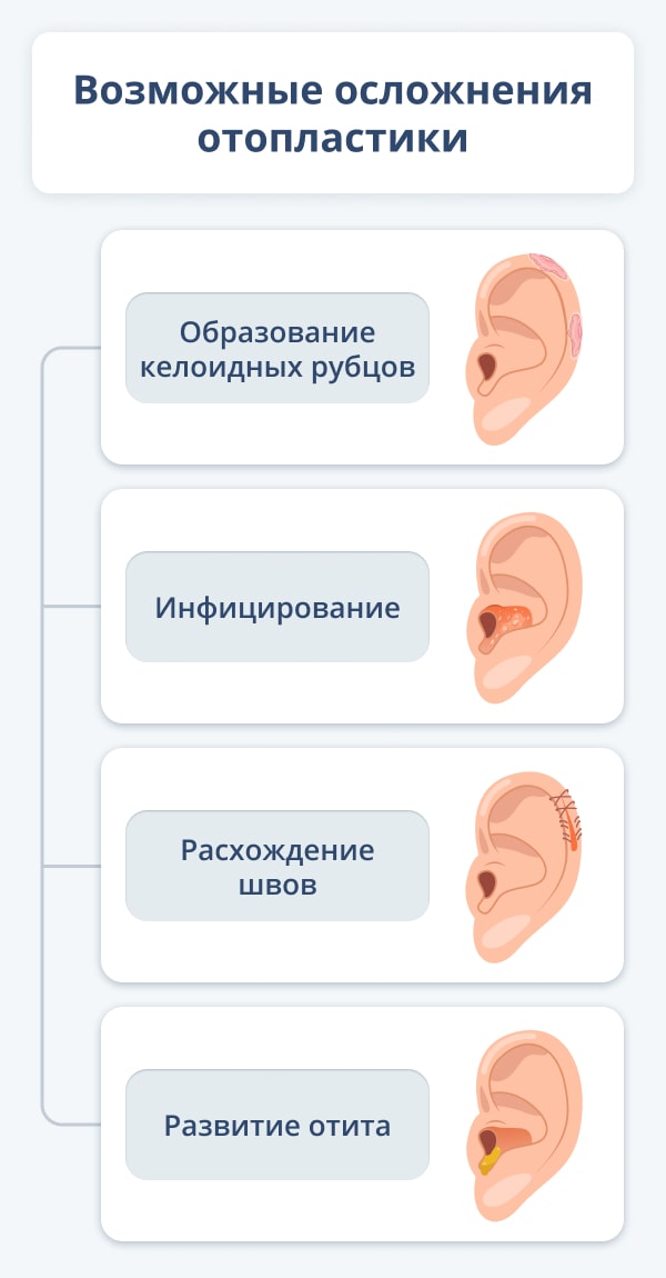 Коррекция ушных раковин - Отопластика | Специалисты из Москвы и Санкт-Петербурга