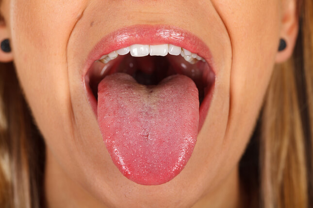 Покраснение горла: симптомы, причины и методы лечения в «СМ-Клиника»