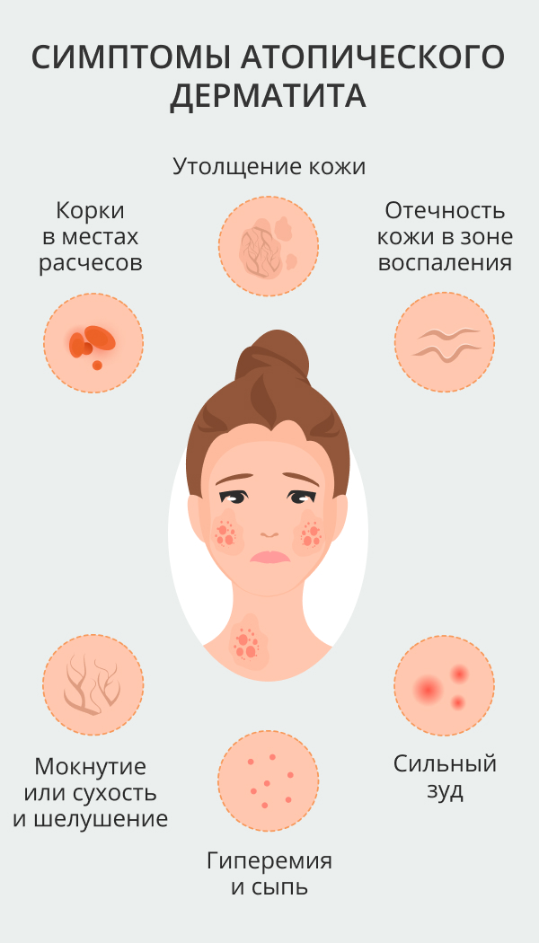 Причины дерматита на шее у взрослого