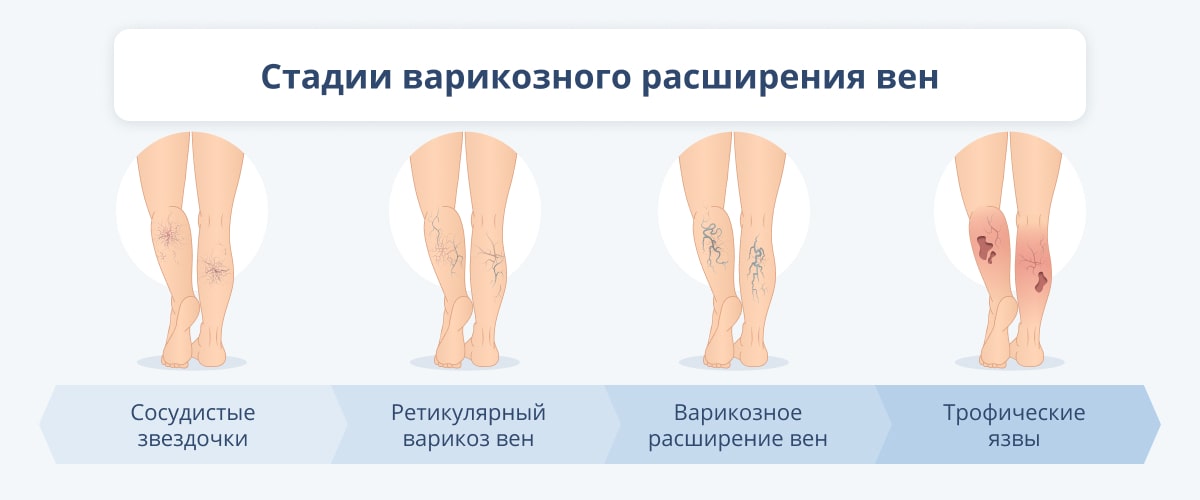 Онемение ног (нижних конечностей) – причины возникновения, диагностика и методы лечения