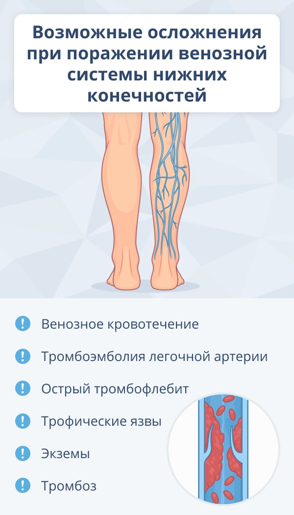 Причины синдрома беспокойных ног