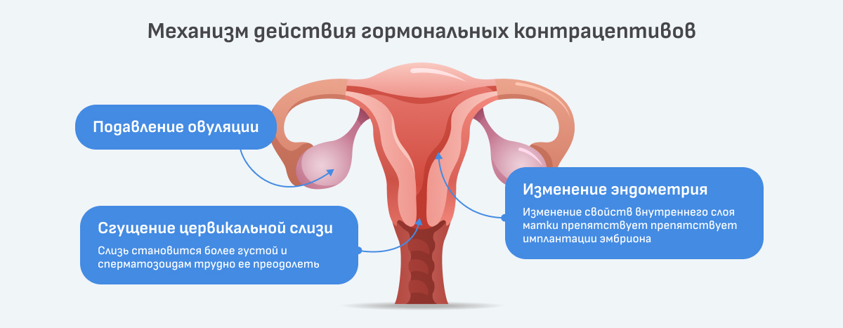 Оральные контрацептивы, подбор противозачаточных препараторов Челябинске.