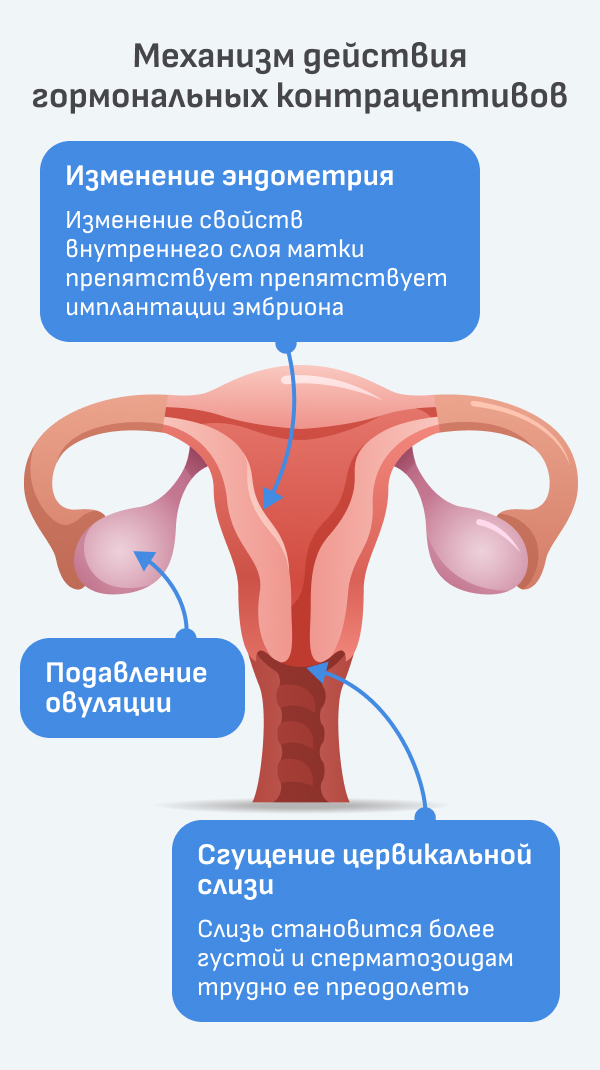 Оральные контрацептивы: виды, как подобрать, принцип действия, плюсы и  минусы женских оральных контрацептивов